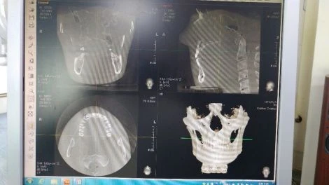 Vatech PaX-Reve3D Panoramic, Cephalometric and CBCT Dental X-Ray — Radiology & Capital Imaging — view 2