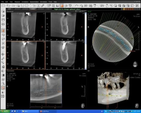 Vatech PaX-Uni3D Panoramic, Cephalometric and CBCT Dental X-Ray — Radiology & Capital Imaging — view 2