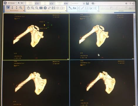 GE Advantage Workstation AW 4.7 (VolumeShare 7), HP Z820 — Radiology & Capital Imaging — view 3