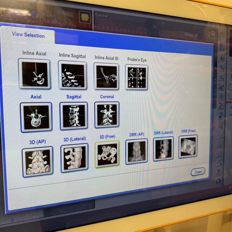 Brainlab Curve 1.1 Dual Navigation System (19901), 2016 — Navigation Instruments — view 5