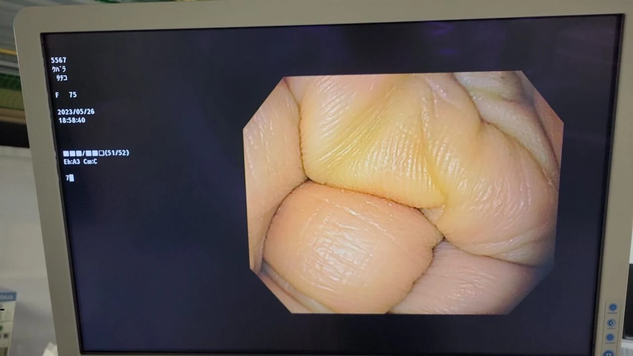 Olympus GIF-H190N Gastroscope, 2018, Patient Ready — Endoscopy Equipment — view 4
