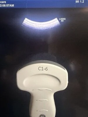 GE C1-6-D XDclear Convex Probe for LOGIQ E9, E10 and Vivid — Ultrasound Probes — view 2