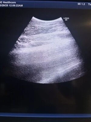 GE C1-6-D XDclear Convex Probe for LOGIQ E9, E10 and Vivid — Ultrasound Probes — view 3