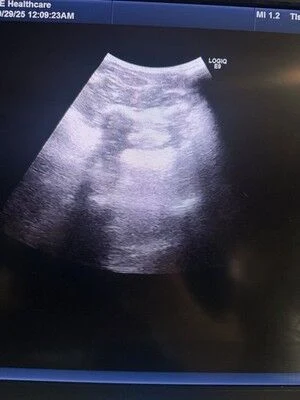 GE C1-6-D XDclear Convex Probe for LOGIQ E9, E10 and Vivid — Ultrasound Probes — view 4