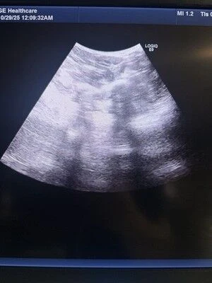 GE C1-6-D XDclear Convex Probe for LOGIQ E9, E10 and Vivid — Ultrasound Probes — view 5