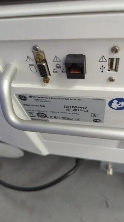 GE Voluson E6 Ultrasound System — Ultrasound Machines — view 10