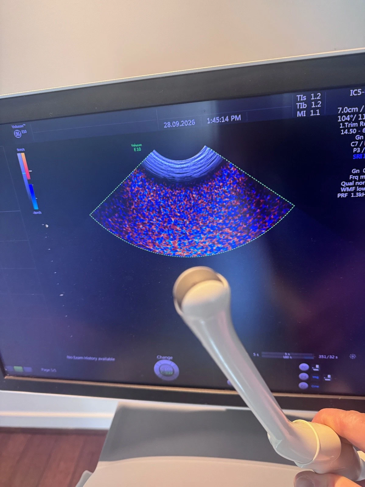 GE Voluson E10 BT15 Ultrasound System with C4-8-D, S4-10-D, IC5-9-D Probes, 3D/4D, Sony Printer — Ultrasound Machines — view 7