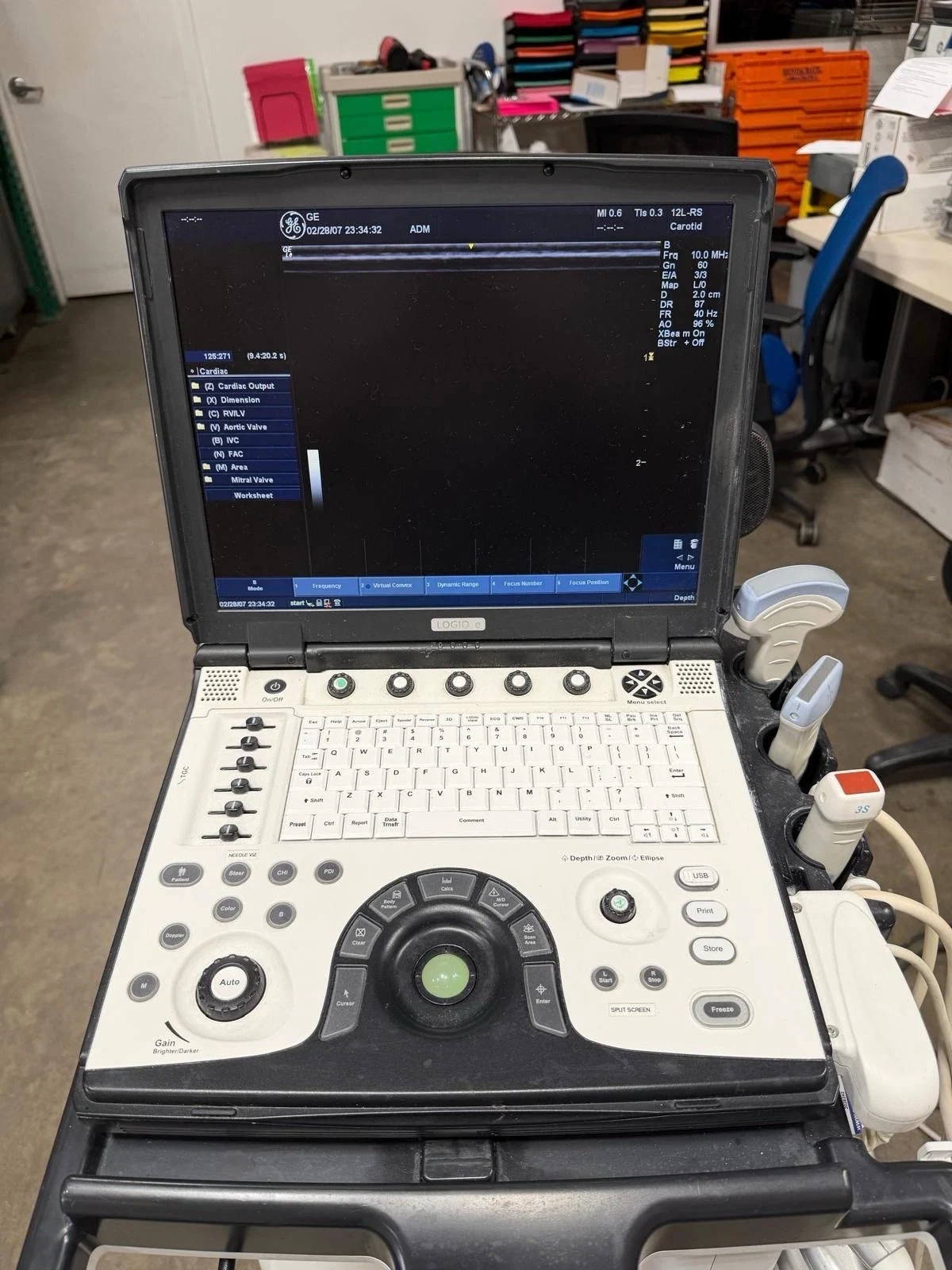 GE LOGIQ e Portable Ultrasound System with 3 Probes (No Cart)