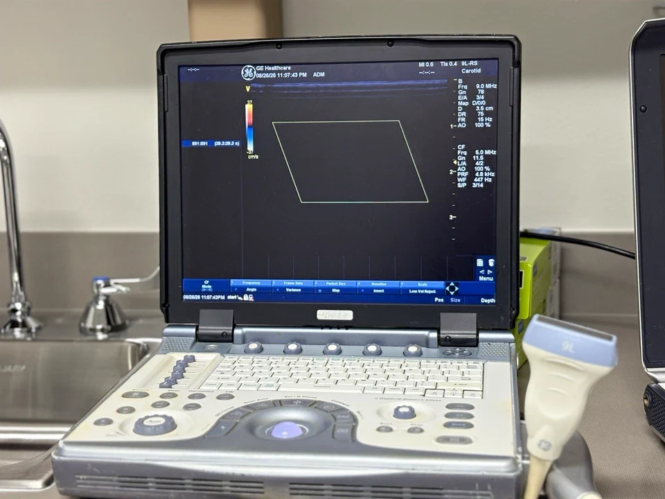 GE Vivid e Portable Cardiovascular Ultrasound with 3S-RS and 9L-RS Probes, Color and PW Doppler