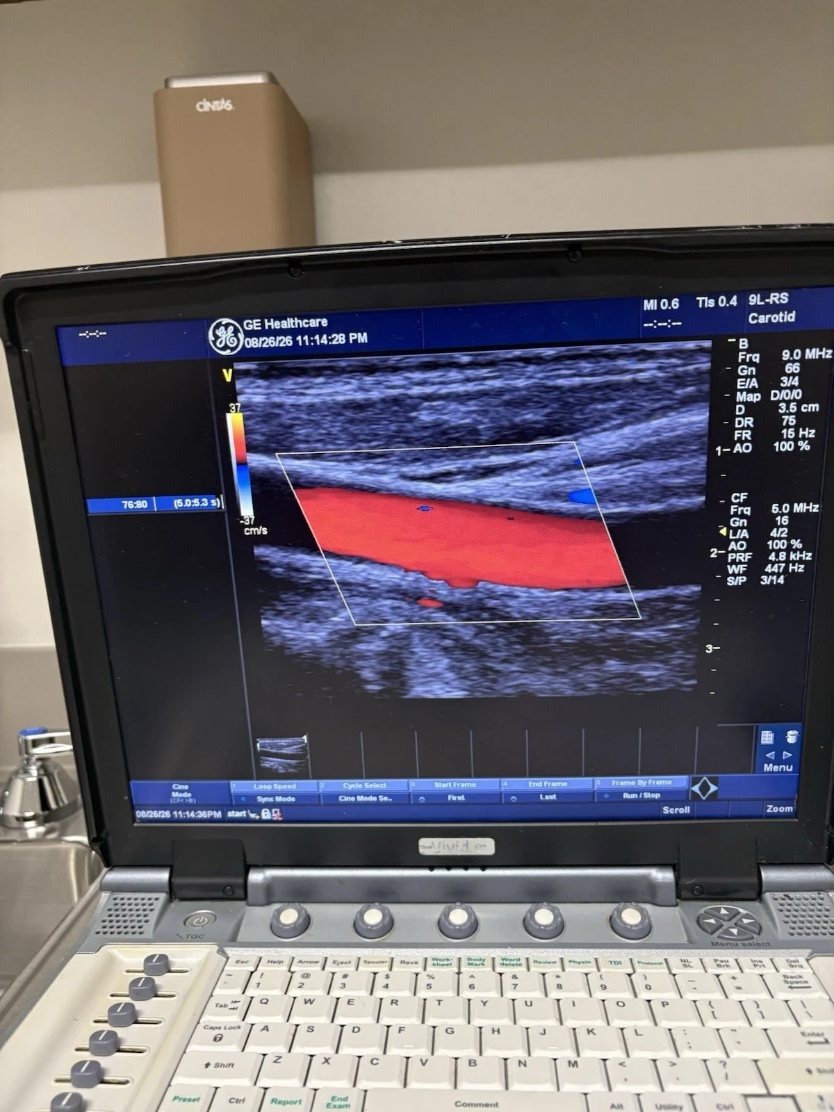 GE Vivid e Portable Cardiovascular Ultrasound with 3S-RS and 9L-RS Probes, Color and PW Doppler — Ultrasound Machines — view 4