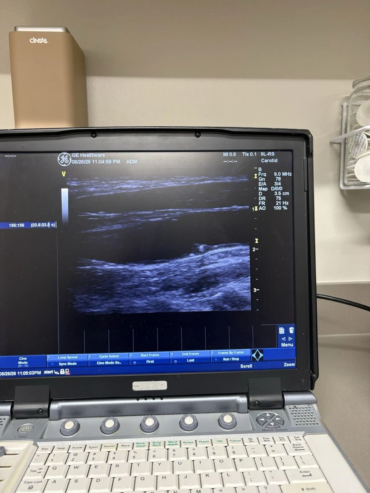GE Vivid e Portable Cardiovascular Ultrasound with 3S-RS and 9L-RS Probes, Color and PW Doppler — Ultrasound Machines — view 6