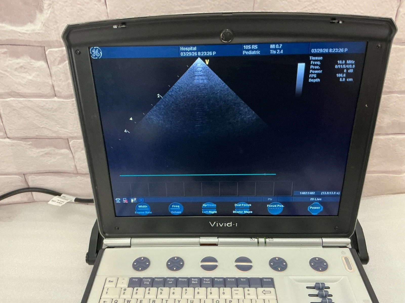GE Vivid i Portable Cardiac and Pediatric Ultrasound with 10S-RS and 8C-RS Probes, All Options — Ultrasound Machines — view 3