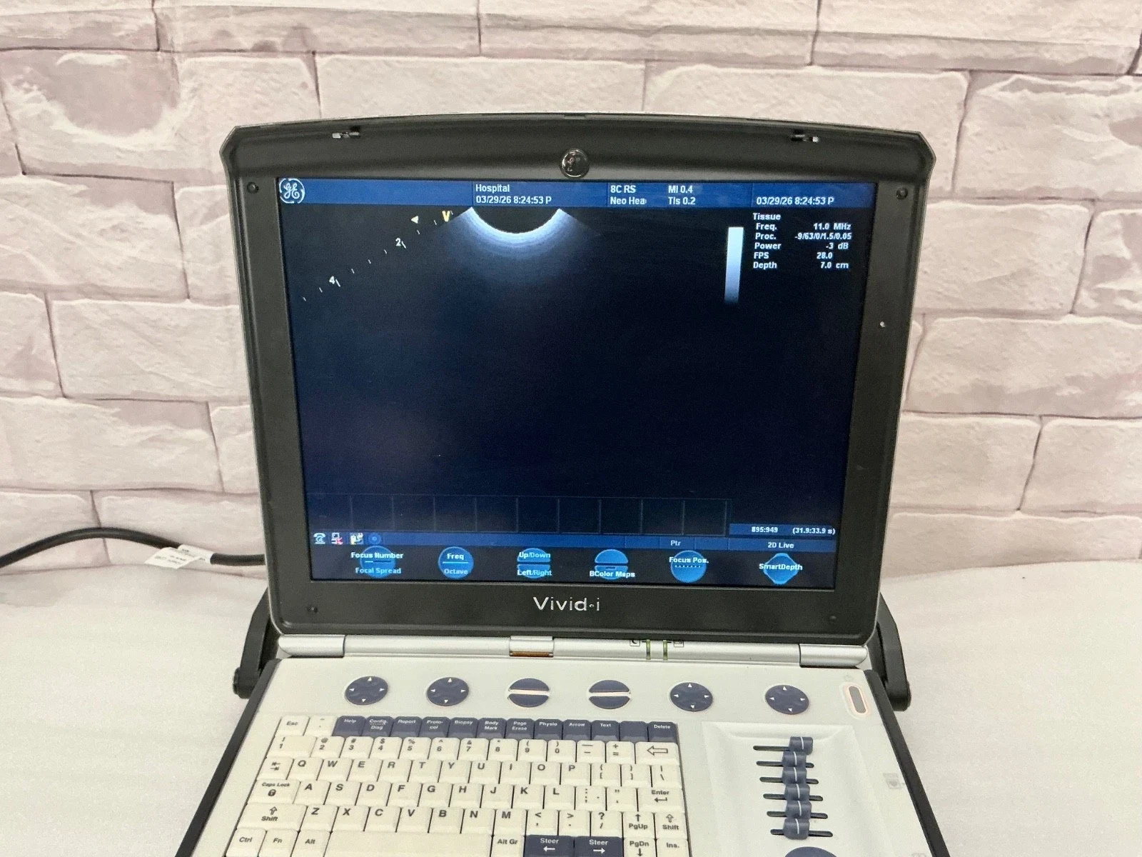 GE Vivid i Portable Cardiac and Pediatric Ultrasound with 10S-RS and 8C-RS Probes, All Options — Ultrasound Machines — view 4